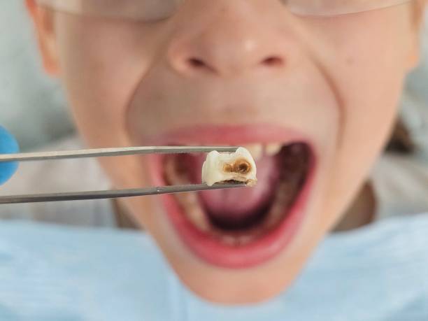 Best Emergency Pediatric Dentist  in Trowbridge Park, MI